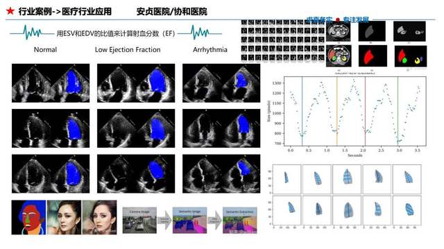 医疗行业应用