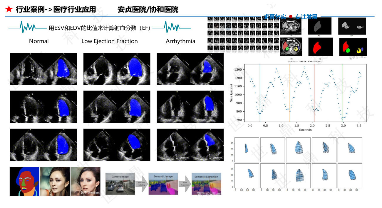 懒加载的图片 72